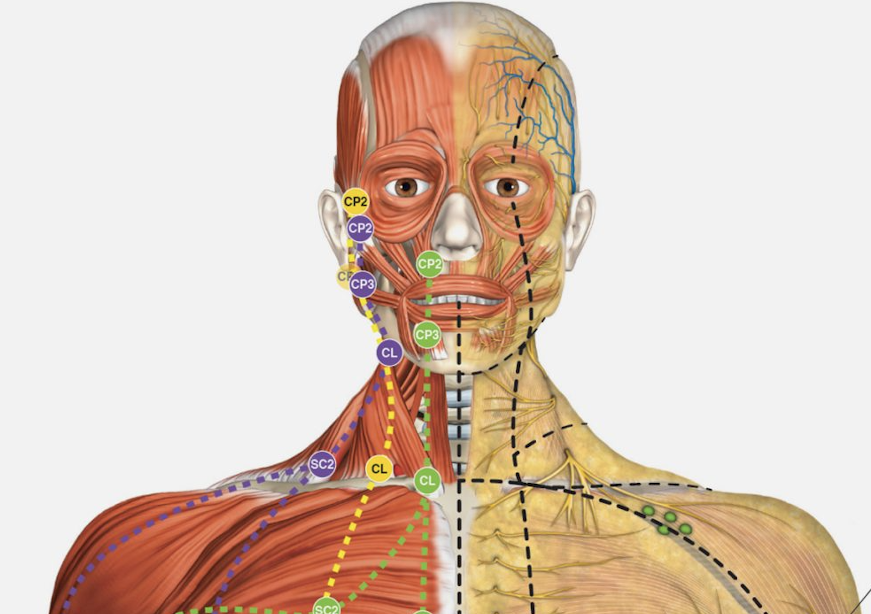 Fascial manipulation method - Level I