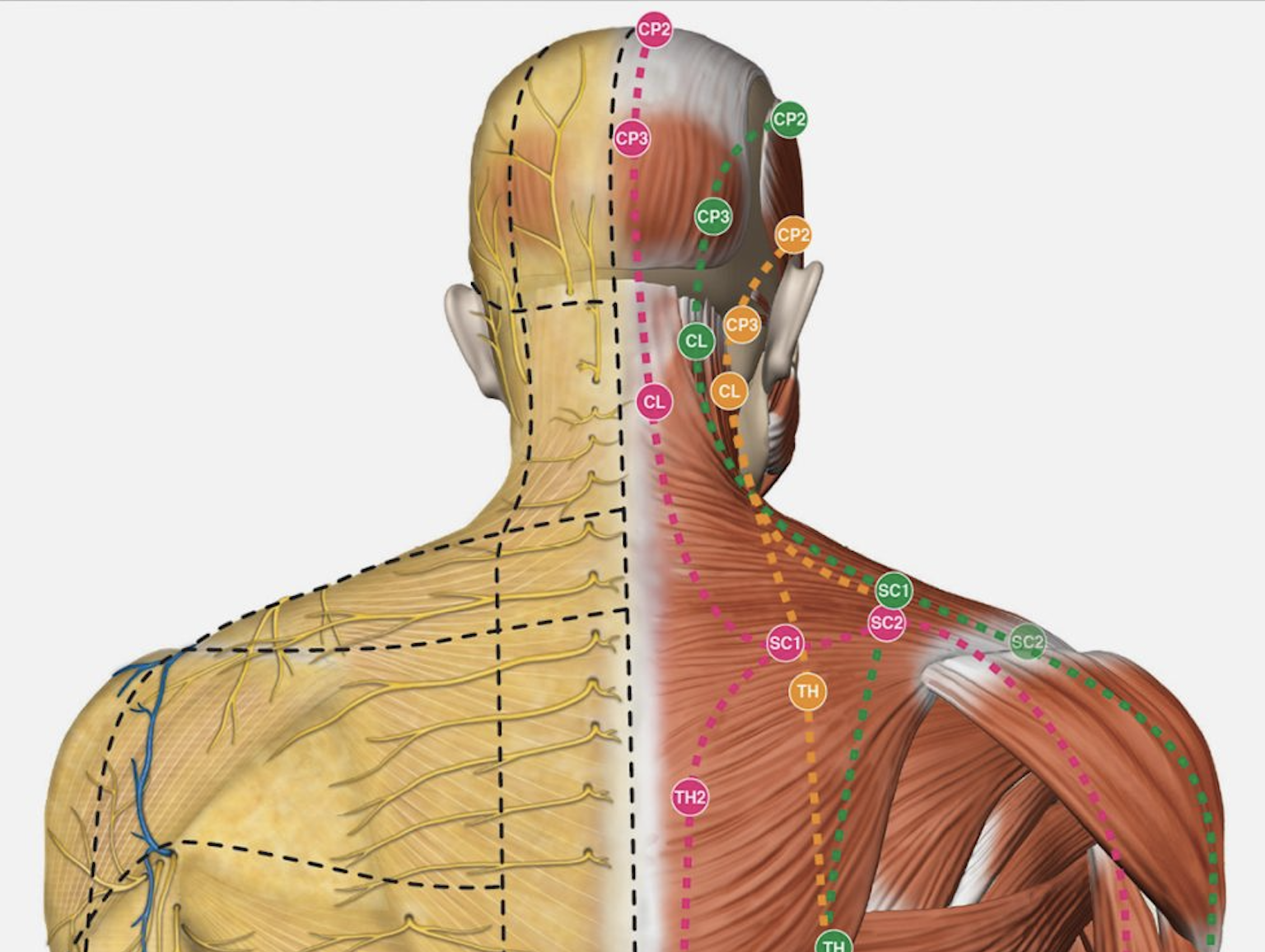 Fascial manipulation method - Level II