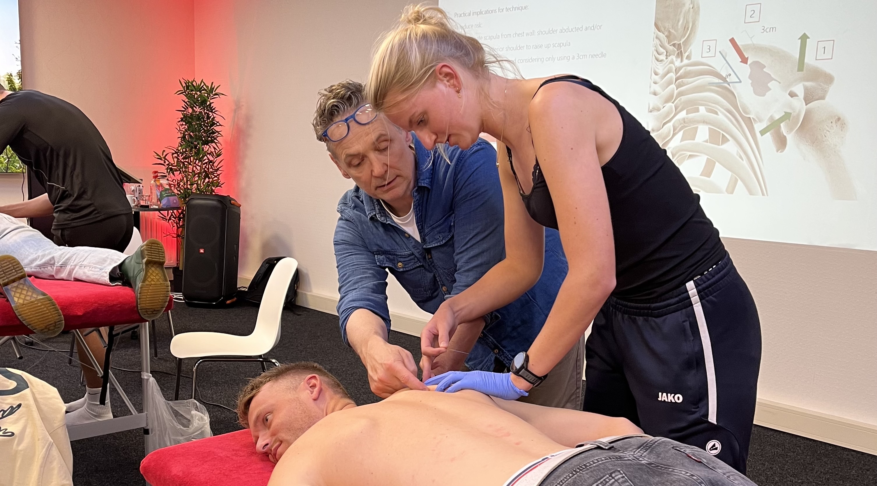 Dry needling - Advanced