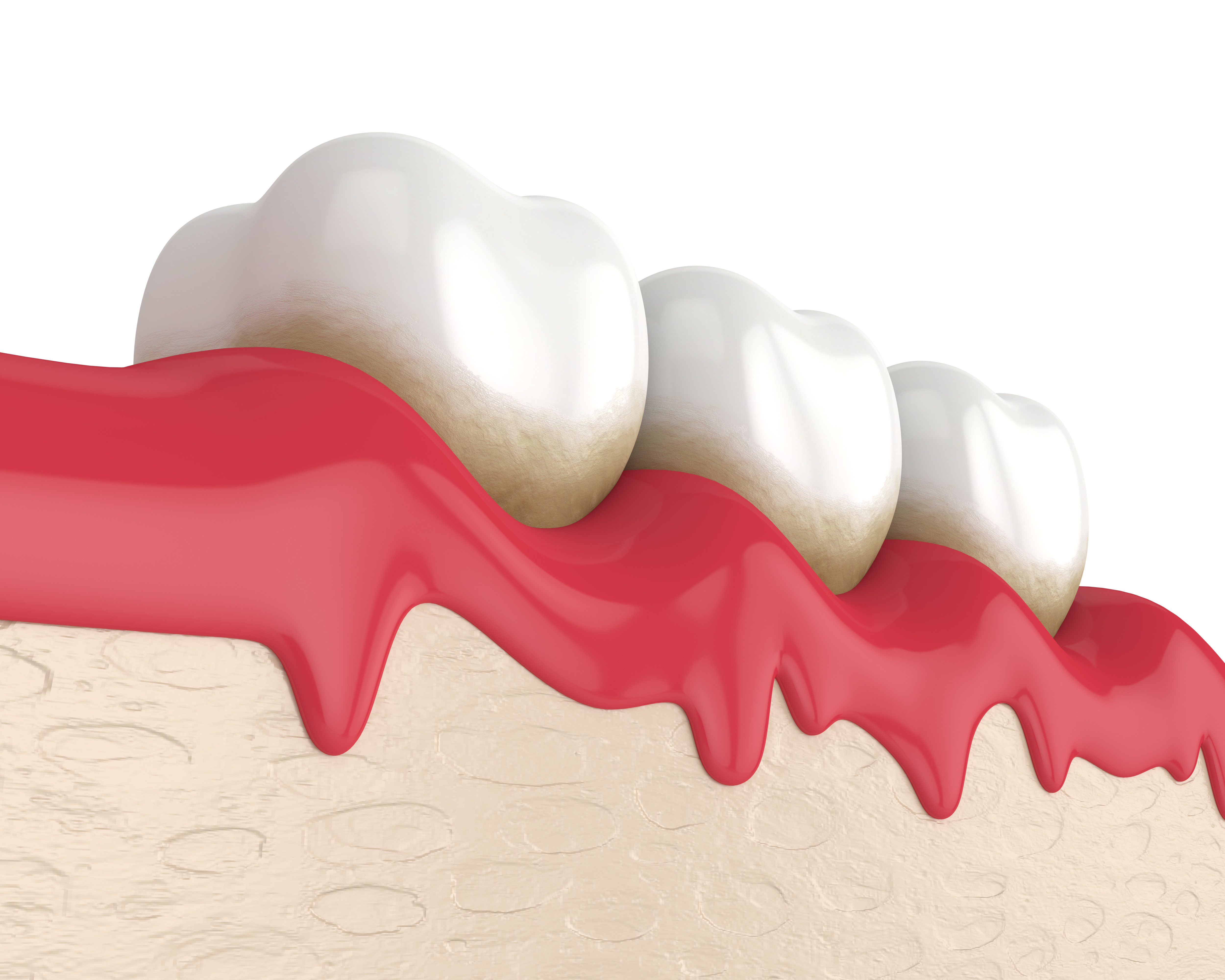 Dental%20peridontal.jpeg
