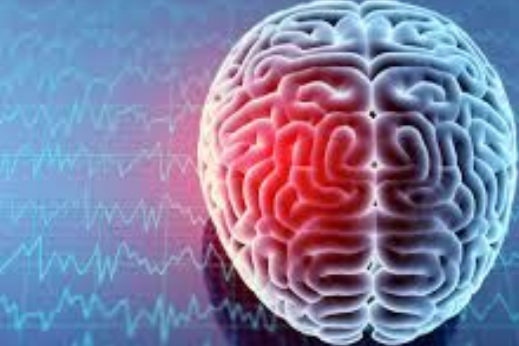 CONCUSSION-AWARNESS%20%281%29.jpg